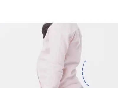 요추 전만