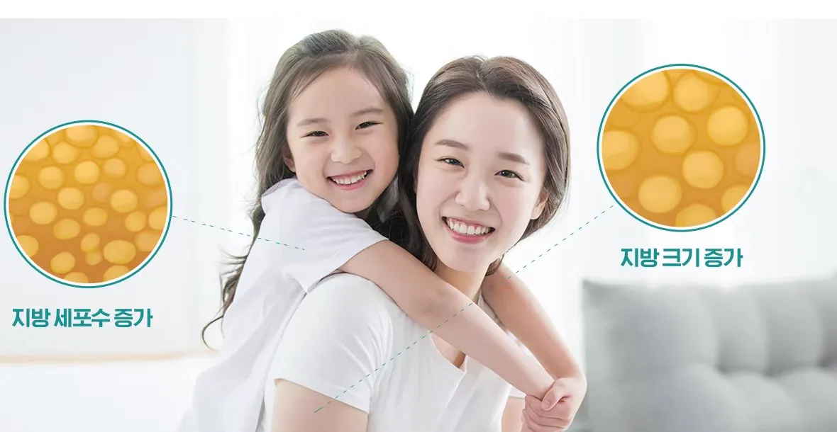 지방 세포 수와 지방 크기 증가 설명